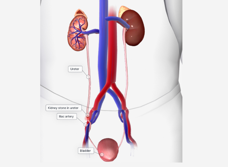 Kidney